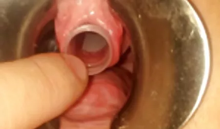 Nóng hậu môn sex vu bu nhat ban ZHMZH